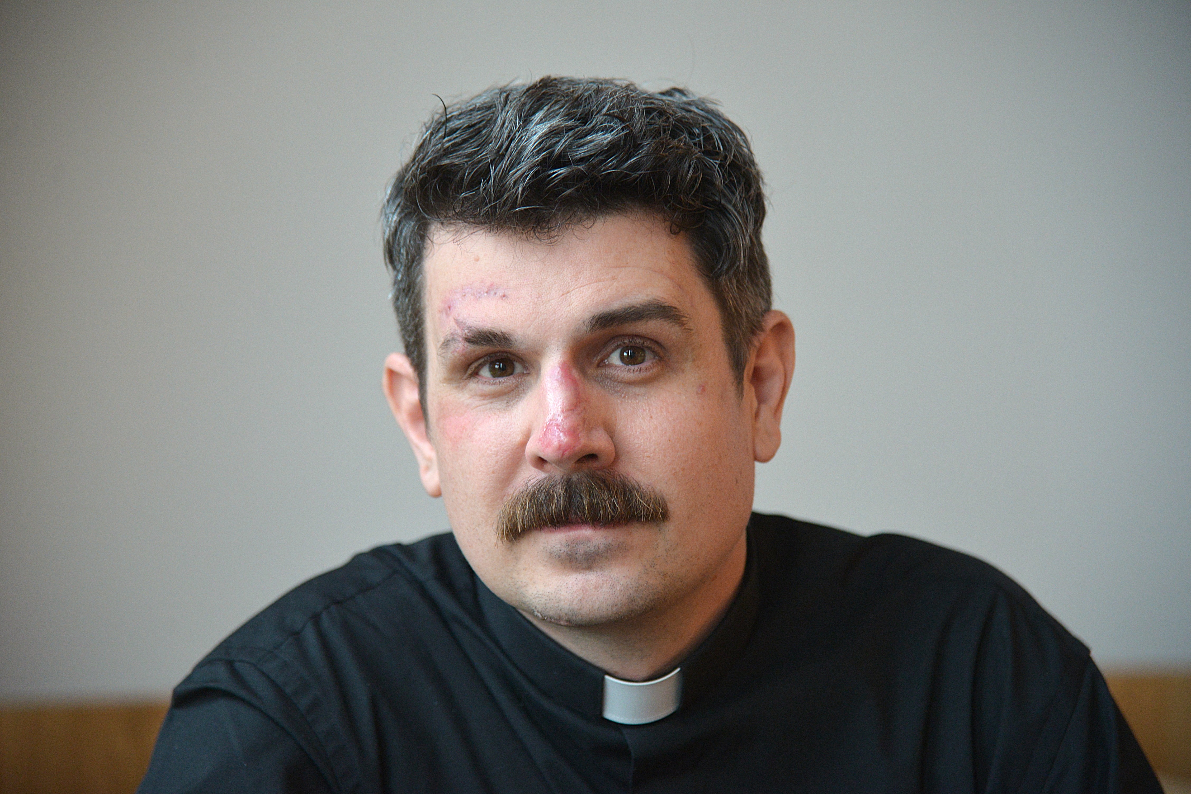 Porträtt av en man med prästkrage, med skador i ansiktet